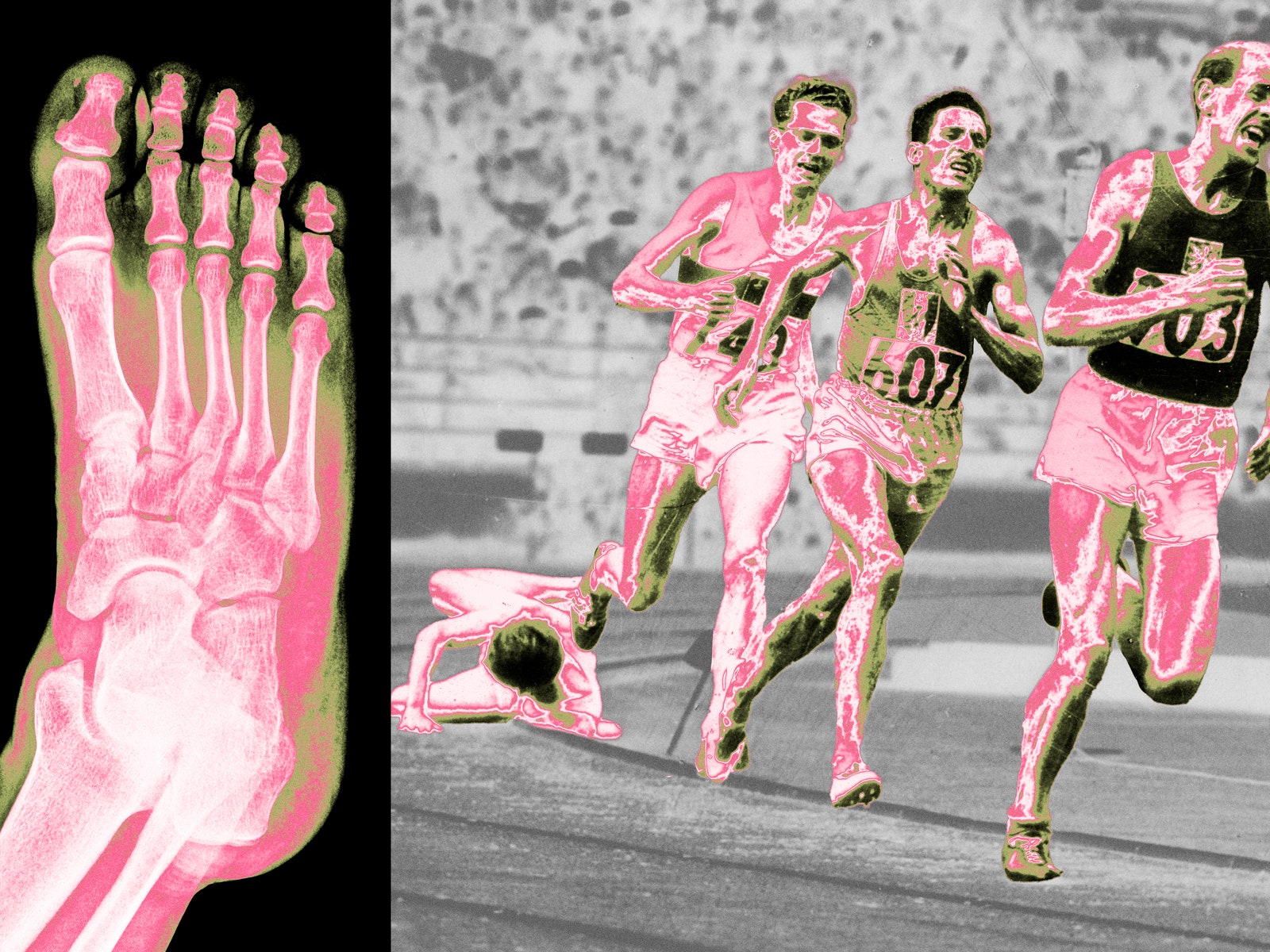 How to Deal With a Gnarly Black Runner’s Toe